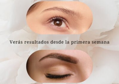 Aceite-antes-despues